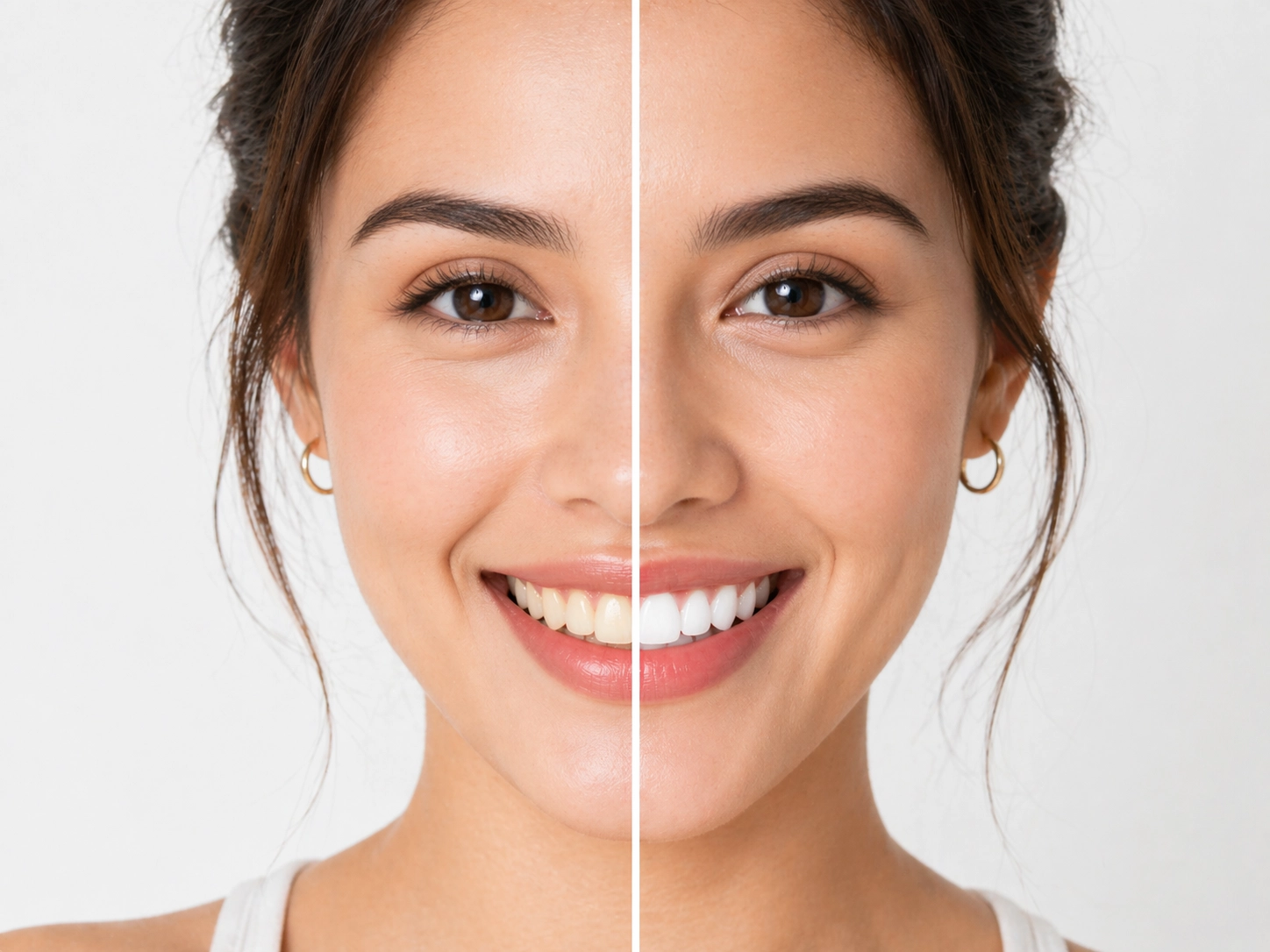 Blanqueamiento dental